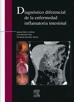 Libro Impreso-DIAGNOSTICO DIFERENCIAL DE LA ENFERMEDAD INFLAMATORIA INTESTINAL