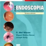 Endoscopia