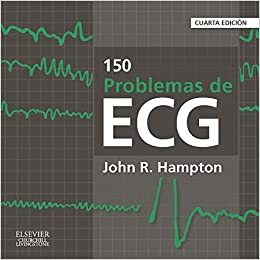 Oferta Especial150 problemas de ECG-4ed