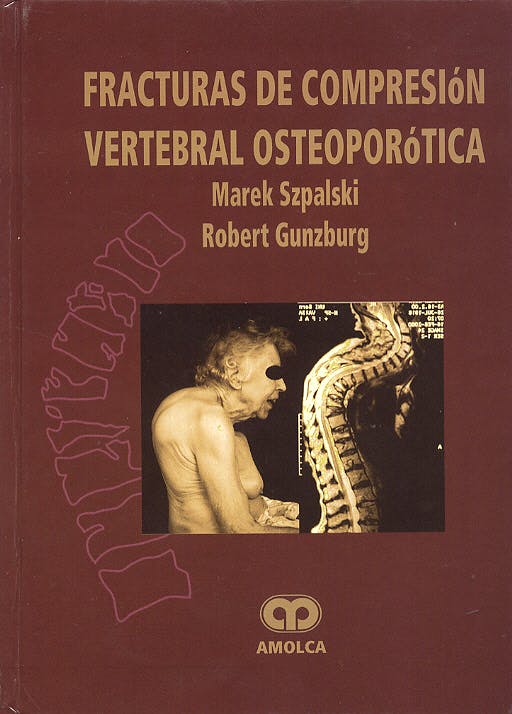 Oferta Especial Fracturas de Comprensión Vertebral Osteoporótica 1Ed