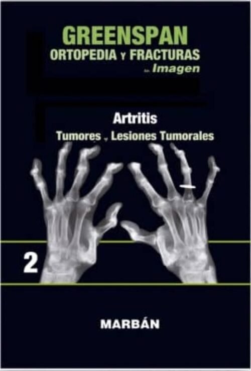 Oferta Especial ORTOPEDIA Y FRACTURAS TOMO II: PREMIUM: ARTRITIS: TUMORES, LESIONES TUMORALES