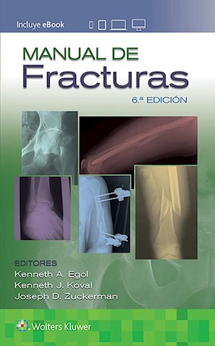 Manual de Fracturas 6ta edición (Incluye acceso a Ebook) Egol