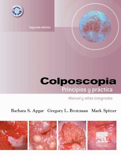 Oferta Especial Colposcopía. Principios y Practica 2º Edición