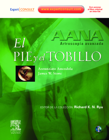 Oferta Especial AANA: ARTROSCOPIA AVANZADA: EL PIE Y EL TOBILLO