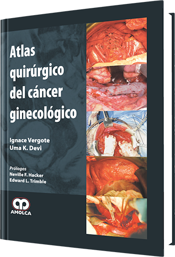 Atlas Quirúrgico del Cáncer Ginecológico