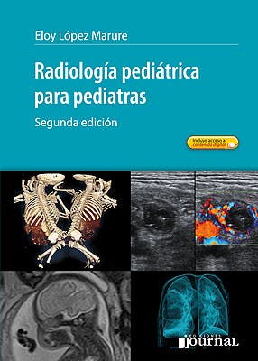 Radiología pediátrica para pediatras – 2ª Ed.