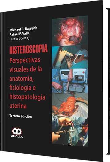 Oferta Especial Histeroscopia. Perspectivas Visuales de la Anatomía, Fisiología e Histopatología Uterina