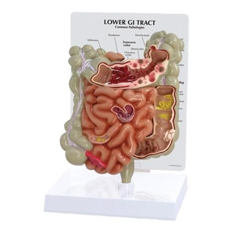 Modelo Anatómico del Tracto Gastrointestinal Inferior