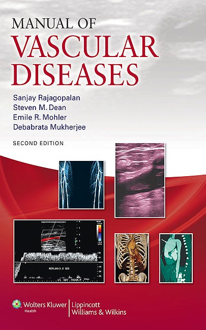 Libro Impreso: Manual of Vascular Diseases 2ed
