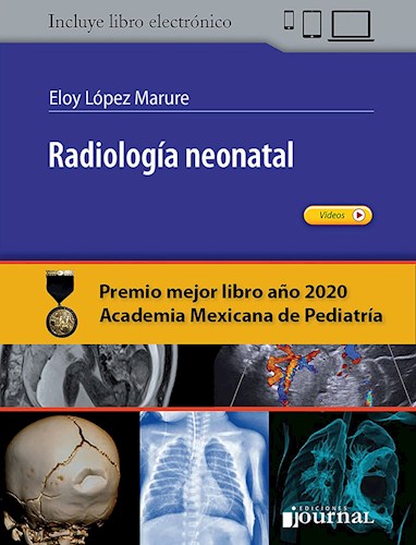 Oferta Especial Libro Impreso Radiología neonatal