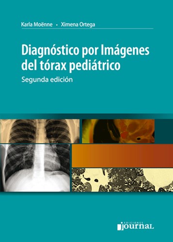 Libro Impreso-Diagnóstico por imagenes del tórax pediátrico – 2ª Ed.