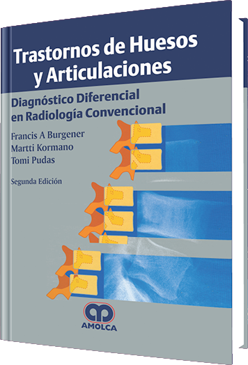 Oferta Especial TRASTORNOS DE HUESOS Y ARTICULACIONES. DIAGNOSTICO DIFERENCIAL EN RADIOLOGIA CONVENCIONAL