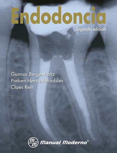 Endodoncia 2ed