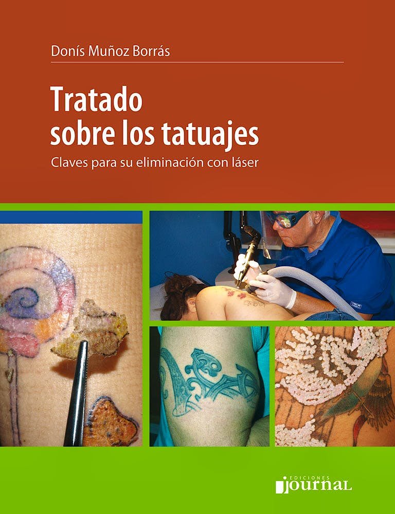 Tratado sobre los Tatuajes. Claves para su Eliminación con Láser Muñoz-Borrás