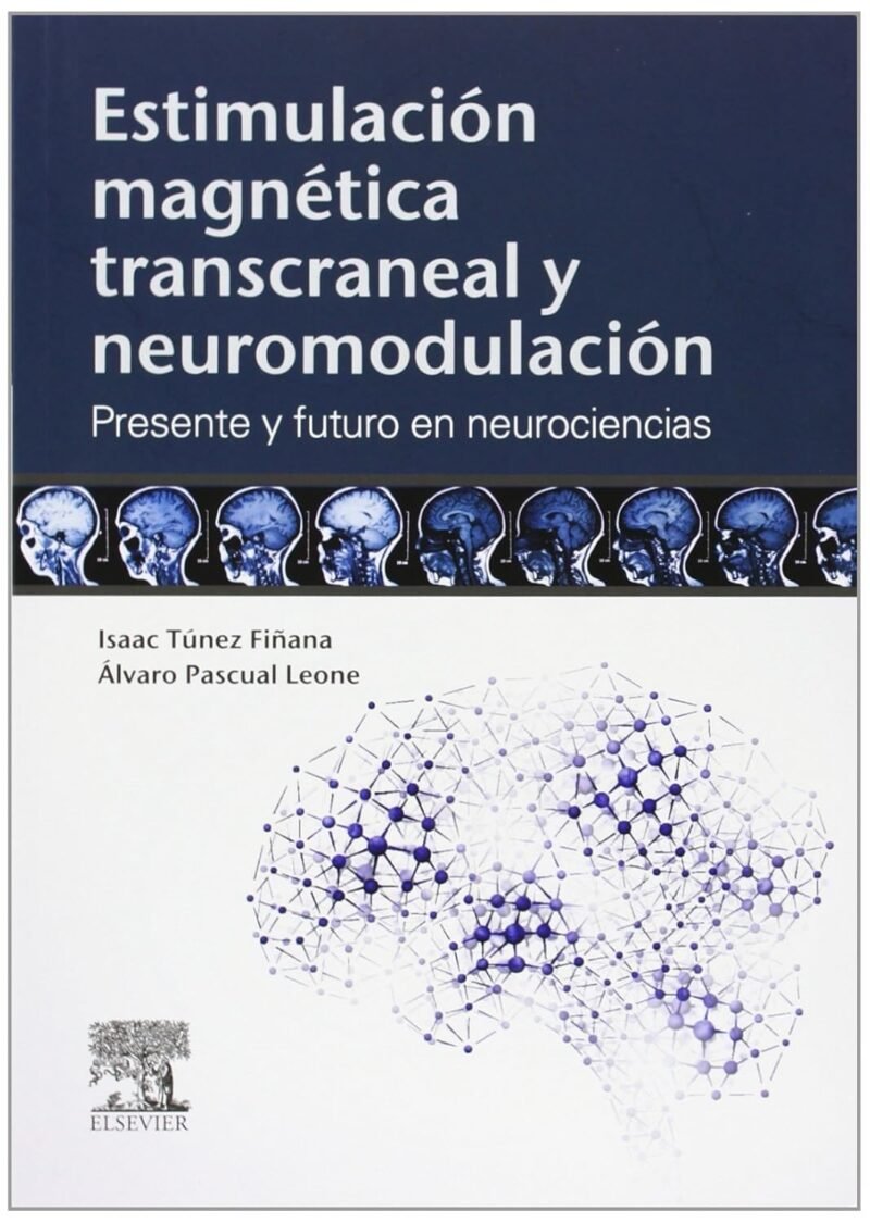 ESTIMULACIÓN MAGNÉTICA TRANSCRANEAL Y NEUROMODULACIÓN I. TUNEZ