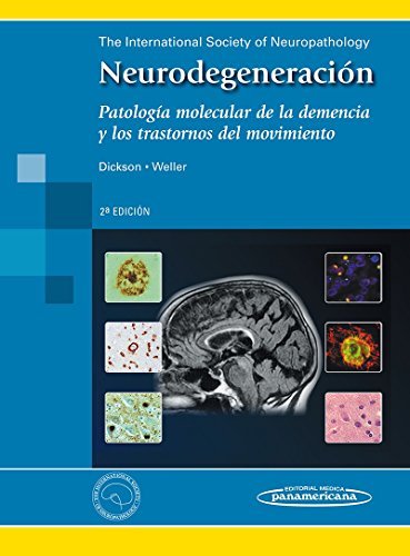 Neurodegeneración: Patología Molecular de la Demencia y los Trastornos del Movimiento 2da ED