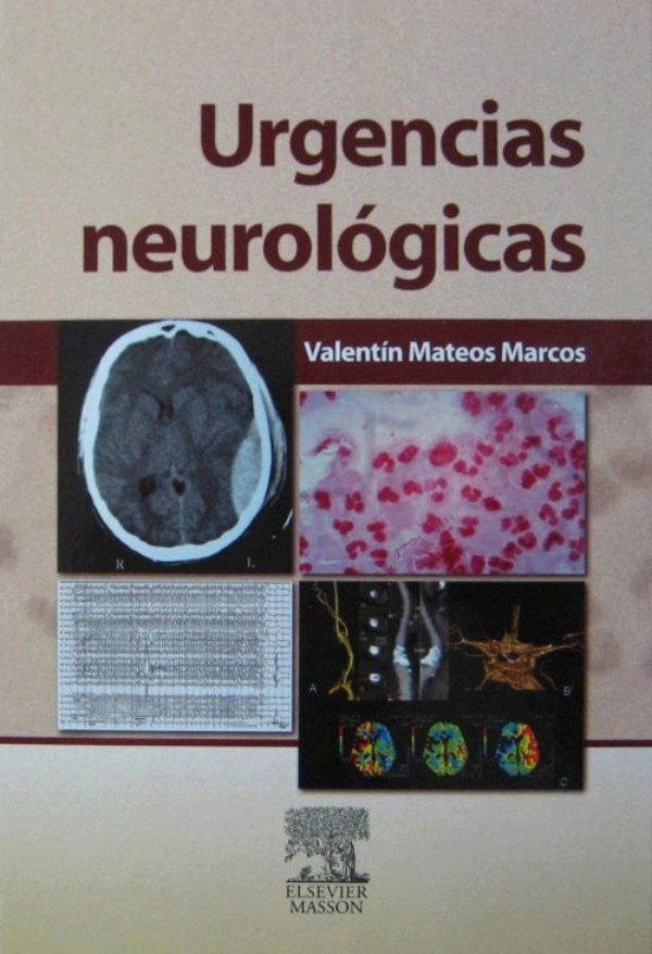 Urgencias Neurológicas Mateos Marcos