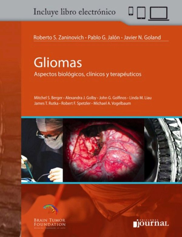 Gliomas: Aspectos biológicos, clínicos y terapéuticos