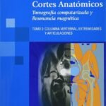 ATLAS BOLSILLO DE CORTES ANATOMICOS T3
