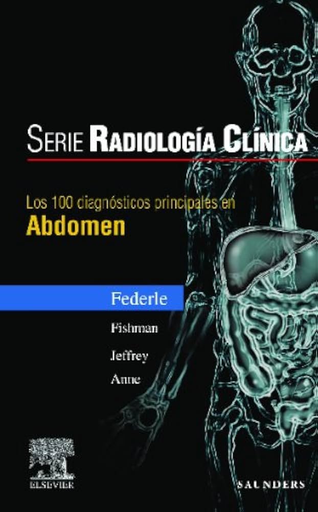 Los 100 Diagnósticos Principales En Abdomen (Serie Pocket de Radiología)