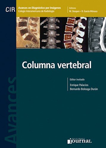 Avances en Diagnóstico por Imágenes: Columna vertebral