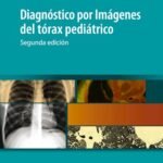 Diagnoistico Por Imagen De L Torax Pediatrico
