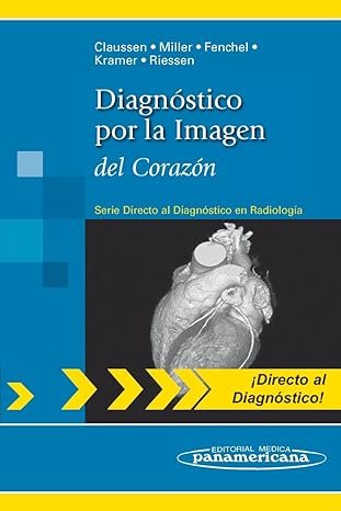 Diagnóstico por la Imagen del Corazón (Directo al Diagnóstico en Radiología)