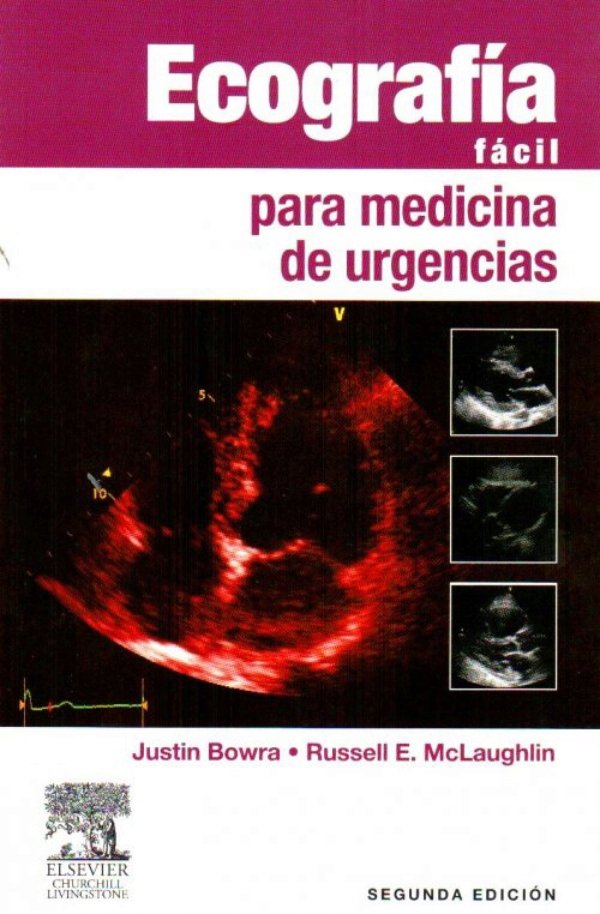 Ecografía fácil para medicina de urgencias