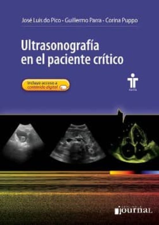 Ultrasonografía en el paciente Critico
