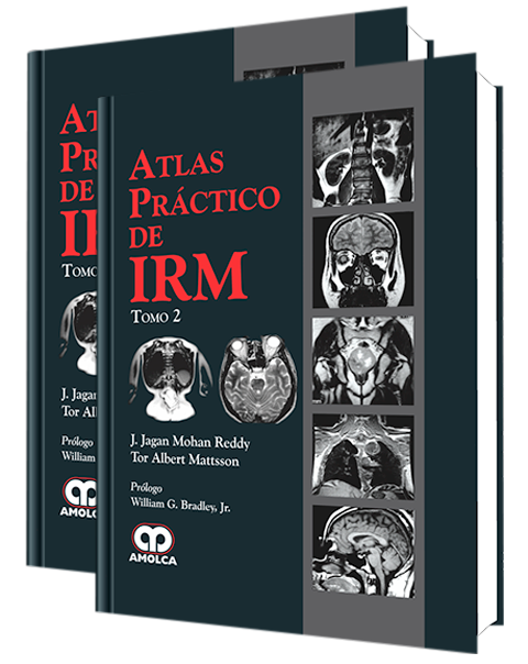 Atlas Práctico de IRM 2 volúmenes