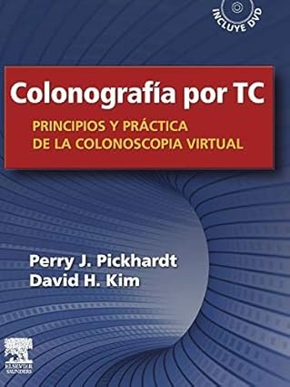 Colonografía por TC: Principios y práctica de la colonoscopia virtual + DVD
