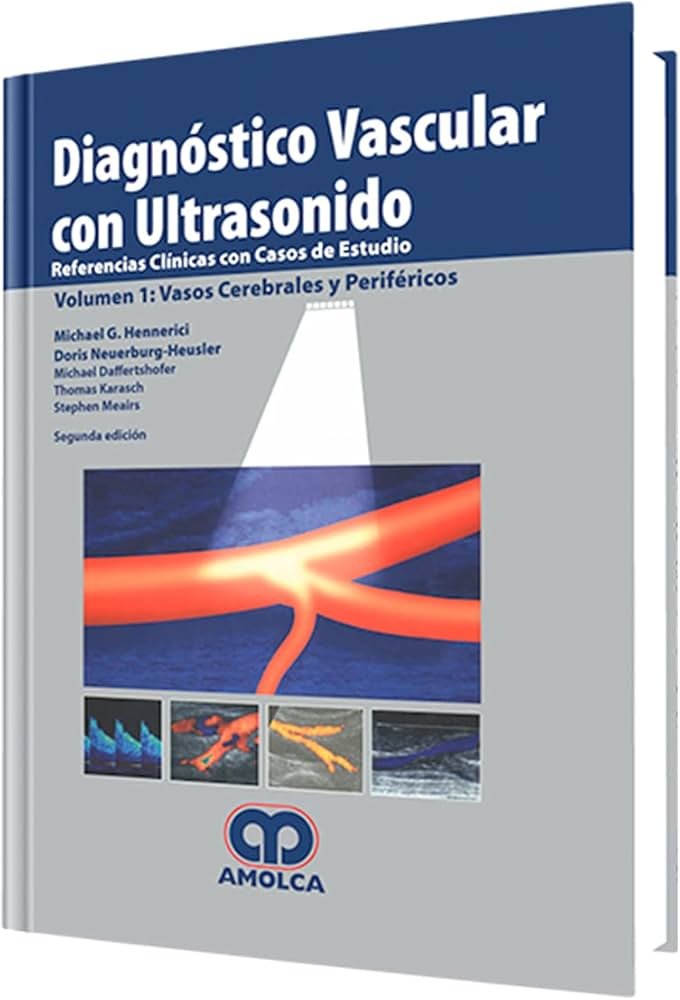 Diagnóstico Vascular con Ultrasonido Referencias Clínicas con caso de estudio Volúmen 1; Vasos Cerebrales y periféricos 2E