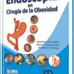 Endoscopia En Cirugia De La Obesidad
