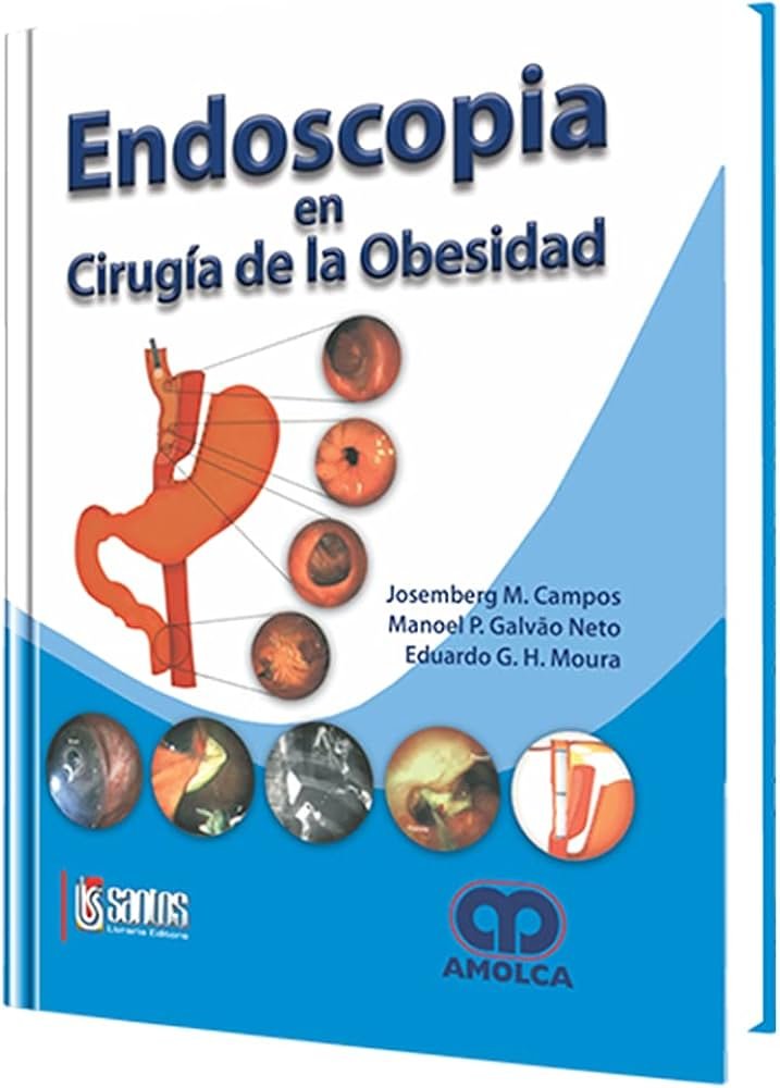 Endoscopia en cirugía de la obesidad