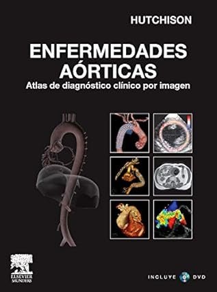 Enfermedades aórticas
