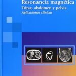 Resonancia Magnetica Toraxabdomen Y Pelvis