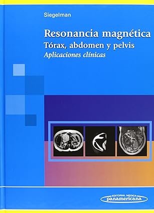 Resonancia Magnética de Tórax y Pelvis