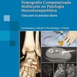 TOMOGRAFIA COMPUTARIZADA MULTICORTE EN P