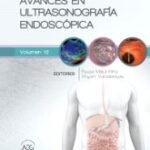 Ultrasonigrafia Endoscospica