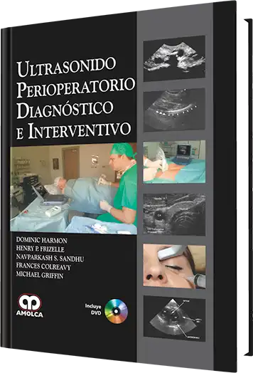 Ultrasonido perioperatorio diagnostico e Interventivo