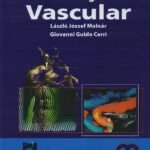 Ultrasonografia Vascular