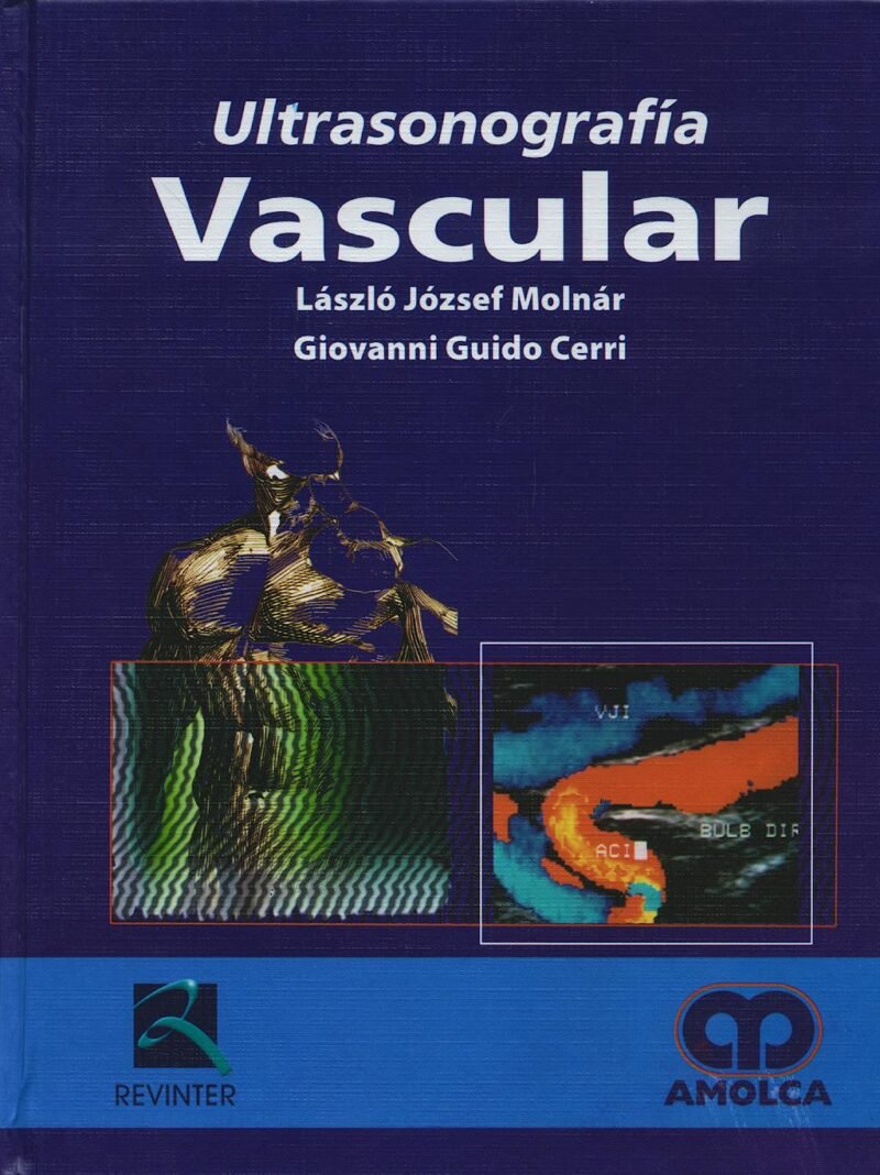 Ultrasonografía Vascular